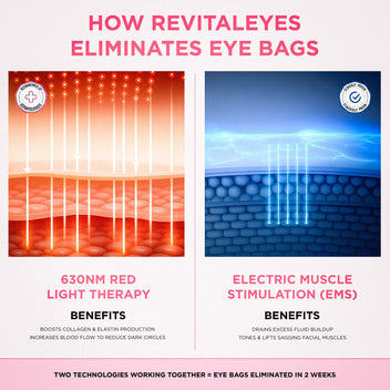 Vive™ 2-in-1 Rotlichttherapie + EMS zur Beseitigung von Tränensäcken